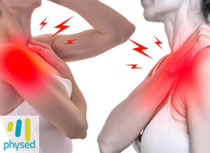 Diagnóstico del Síndrome del desfiladero torácico